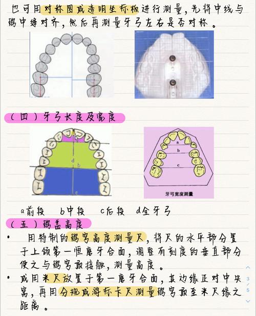 正畸模型测量的内容-图2 正畸模型测量的内容-图2