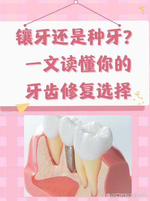 镶牙与植牙，哪个更疼？治疗过程和术后疼痛全对比？-图3