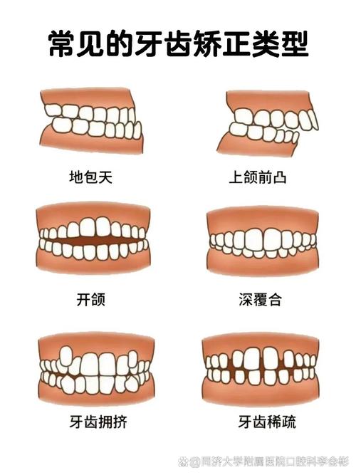 正畸过程问题及解决-图3