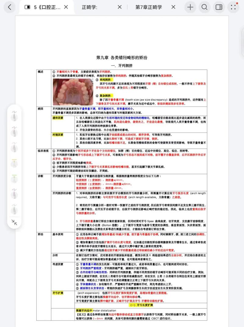 该如何学好口腔正畸-图2