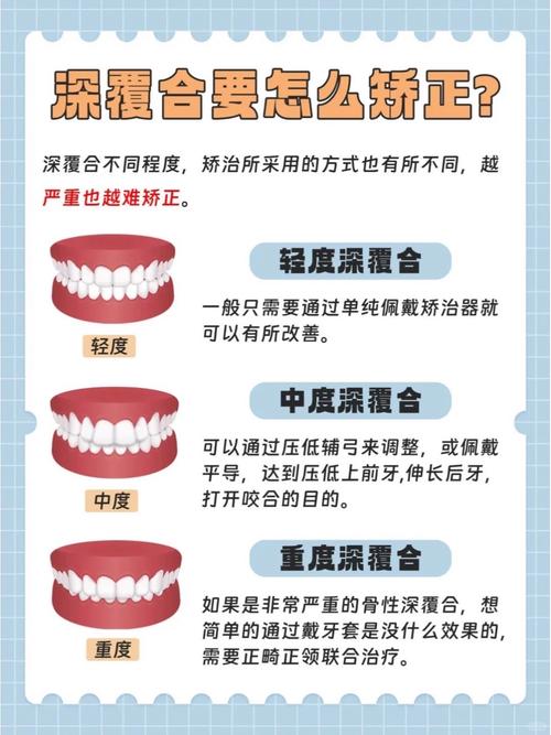 磨牙深覆盖正畸方法-图3