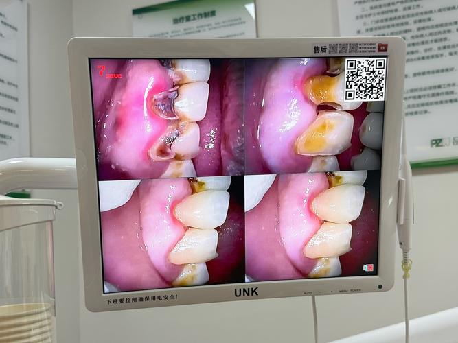 私人诊所拔牙植牙-图3 私人诊所拔牙植牙-图3