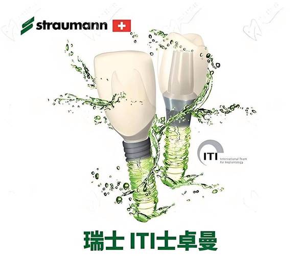 种植牙植体系品牌-图2 种植牙植体系品牌-图2