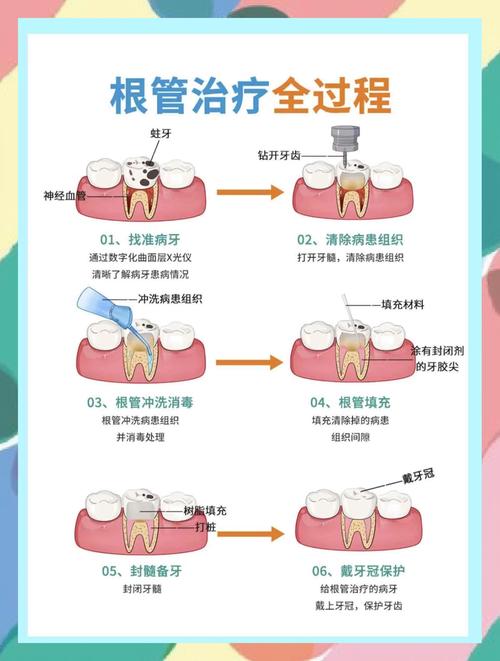 牙根尚存如何植牙？保留牙根的种植方法可行吗？-图1
