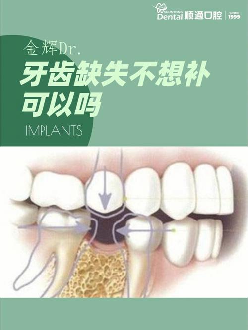 牙齿缺失不能植牙？这些情况真的无解吗？-图3