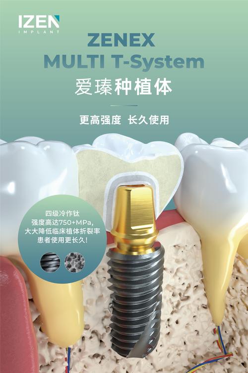 韩国植牙品牌好吗-图3