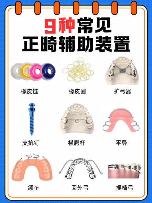 正畸的工具都有那些-图2 正畸的工具都有那些-图2