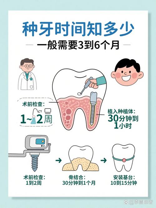 植牙戴牙需要多久-图1