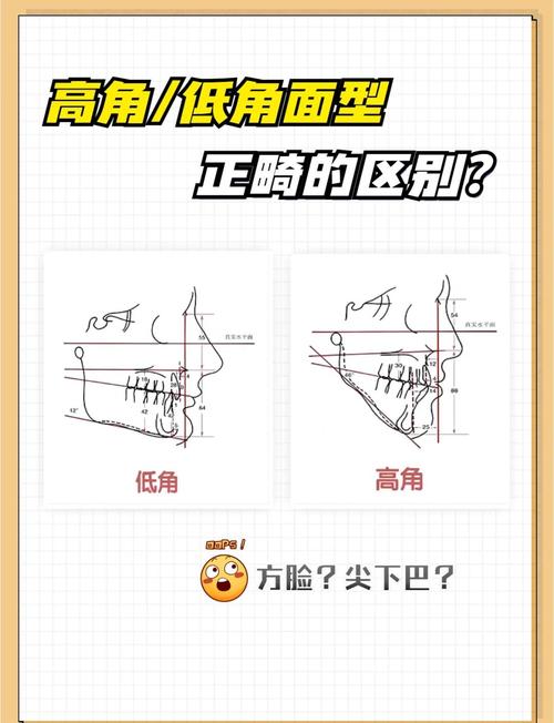 正畸SN MP角度-图2