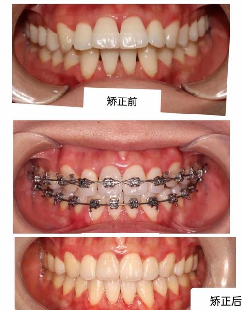 哈尔滨亚美口腔正畸-图1