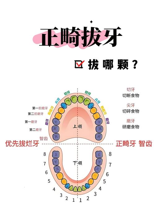 正畸前 拔牙 多久-图3