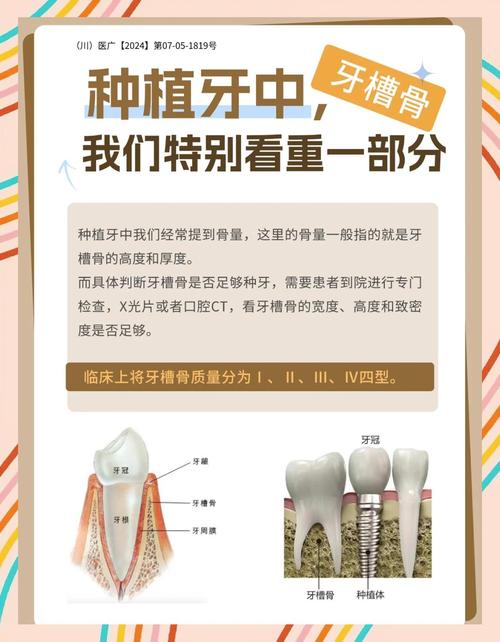 牙植骨有哪些关键注意事项和术后护理要点？-图2
