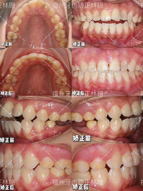 医大附属口腔 正畸-图2