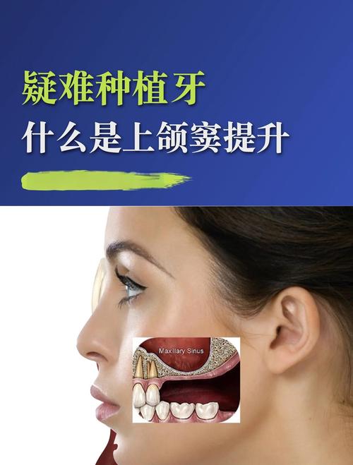 种植牙植骨成功率受哪些关键因素影响?-图3 种植牙植骨成功率受哪些关键因素影响?-图3