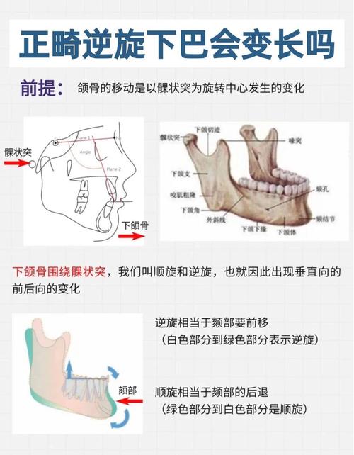 正畸中PP平面与MP平面有何临床意义?-图2 正畸中PP平面与MP平面有何临床意义?-图2