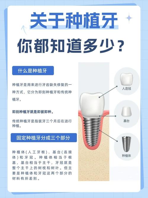 植牙好还是套牙好-图2 植牙好还是套牙好-图2