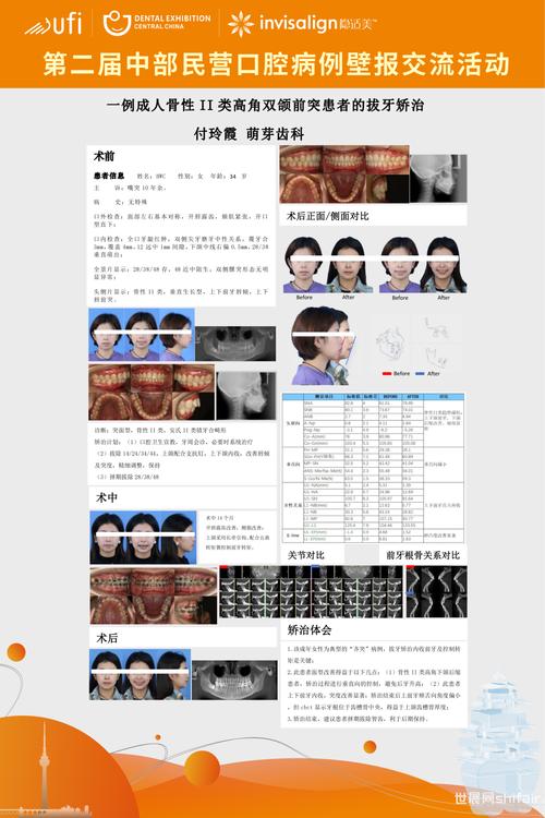 国际正畸联盟WFO-图2 国际正畸联盟WFO-图2