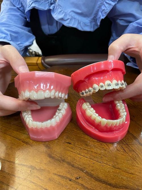 泰山学者口腔正畸技术优势与效果如何？-图3