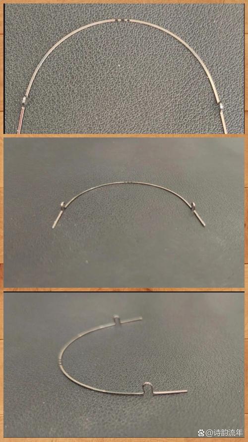 正畸 欧米茄曲图片-图1