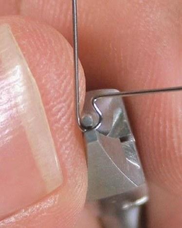 正畸 欧米茄曲图片-图2