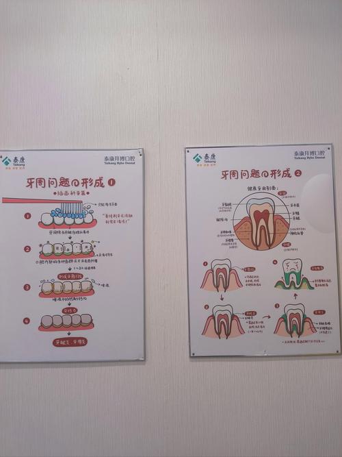 口腔正畸 质控控制-图2