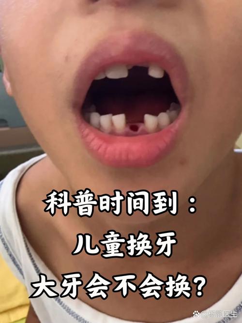 小孩子能植牙吗-图1