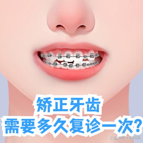正畸复诊后疼痛一般会持续多久？-图3