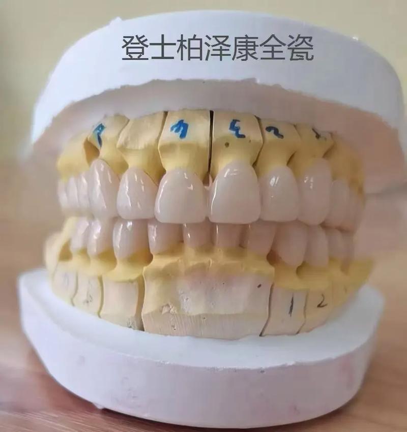 正畸damon陶瓷-图3