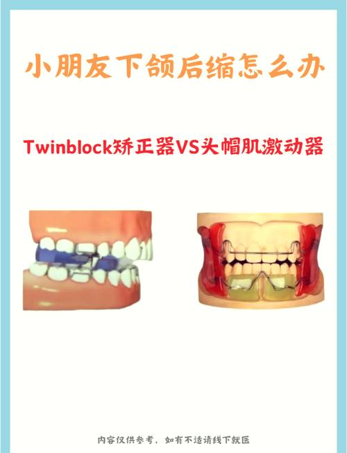 正畸Damon系统矫正效果如何？与传统矫正相比有何优势？-图1