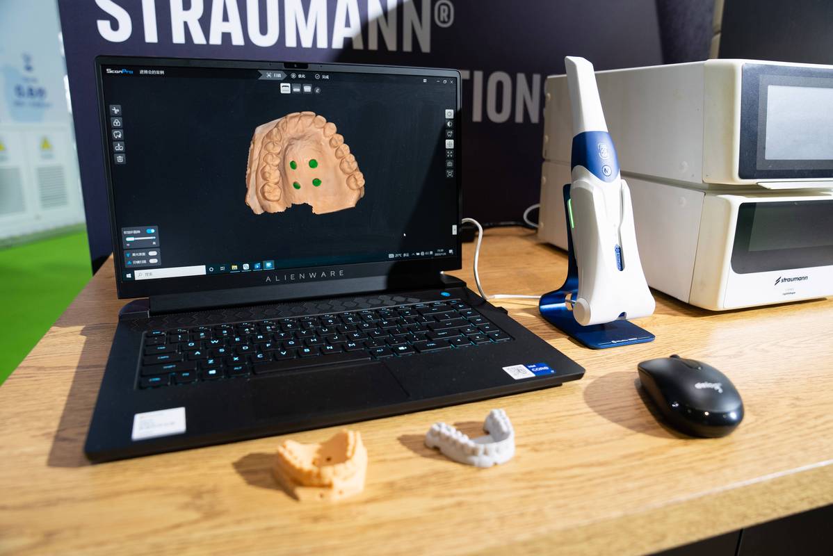 计算机导航植牙相比传统植牙，精准度和安全性优势何在？-图2