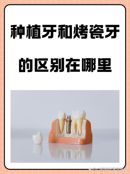 种植牙的种植过程有哪些关键步骤？-图1