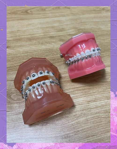 正畸keynote-图1 正畸keynote-图1