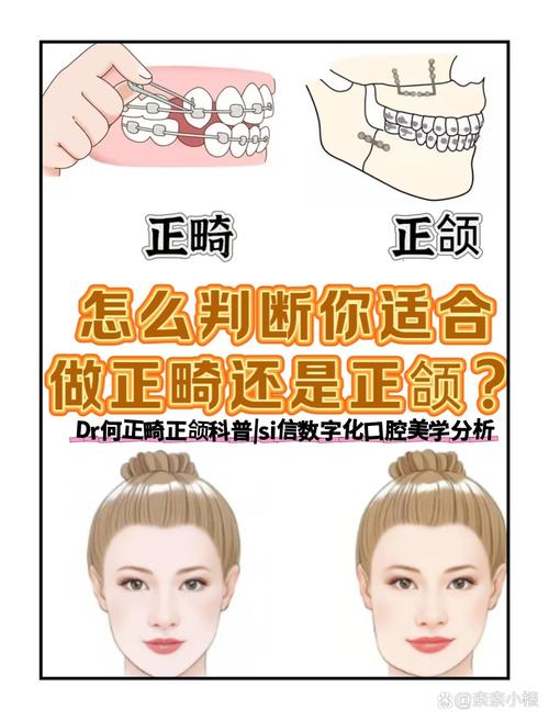 正畸和牙颌正畸区别-图3