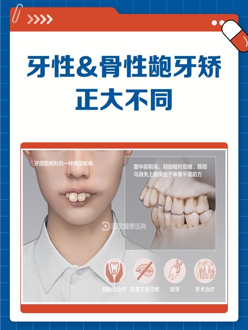 骨性二类错颌患者能通过正畸治疗改善吗?-图1 骨性二类错颌患者能通过正畸治疗改善吗?-图1