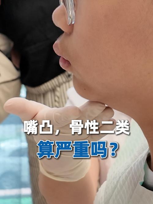 骨性二类错颌患者能通过正畸治疗改善吗?-图3 骨性二类错颌患者能通过正畸治疗改善吗?-图3