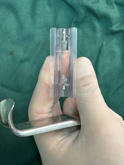 种植牙植体手术-图3 种植牙植体手术-图3