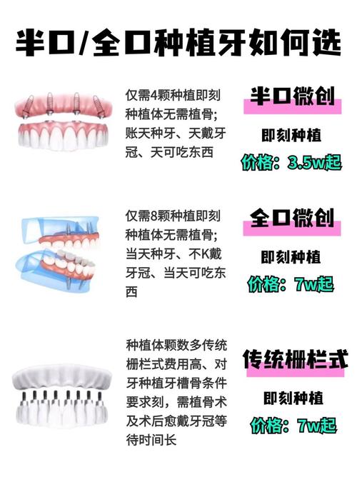 植牙技术差别有多大？哪种技术更适合你？-图1