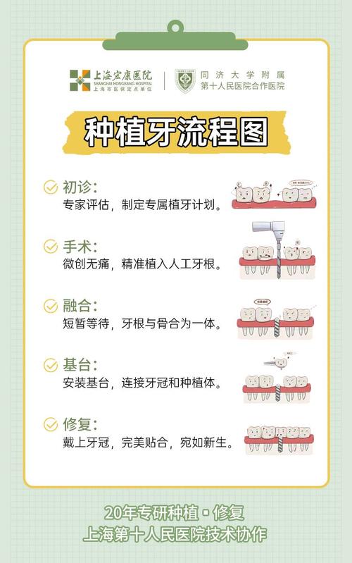 植牙分几个阶段-图2