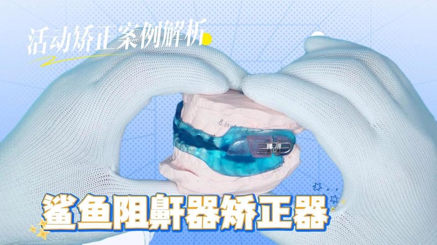 妃她正畸活动矫正器-图1 妃她正畸活动矫正器-图1