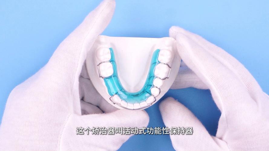 妃她正畸活动矫正器-图2 妃她正畸活动矫正器-图2
