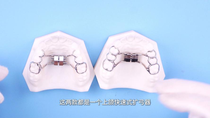 妃她正畸活动矫正器-图3 妃她正畸活动矫正器-图3