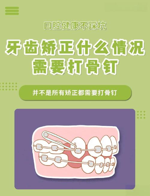 正畸不打骨钉可以吗-图1