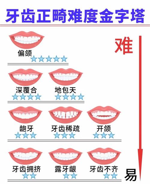 什么情况不适合正畸-图2