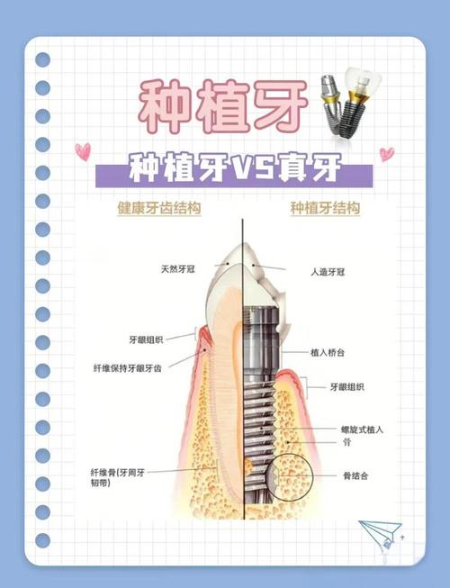 夏季可以植牙吗-图1