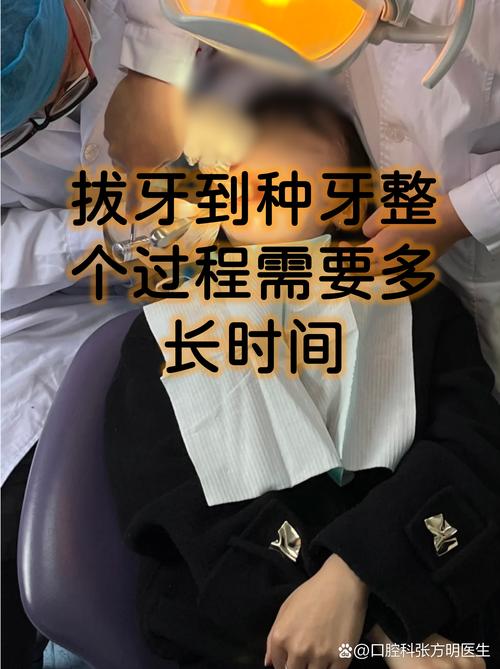 植牙后多久能彻底愈合？愈合周期一般需要多久？-图2