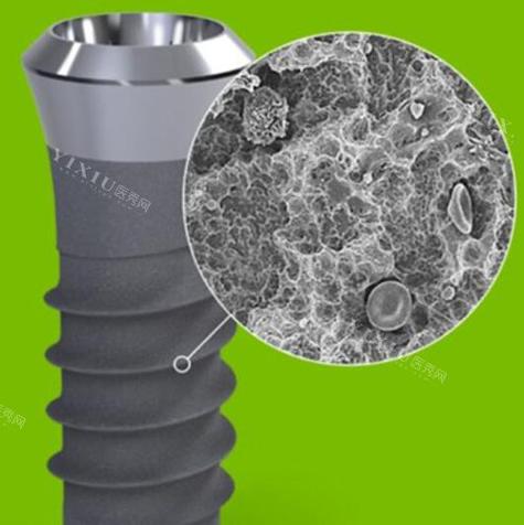 dio植牙系统-图1