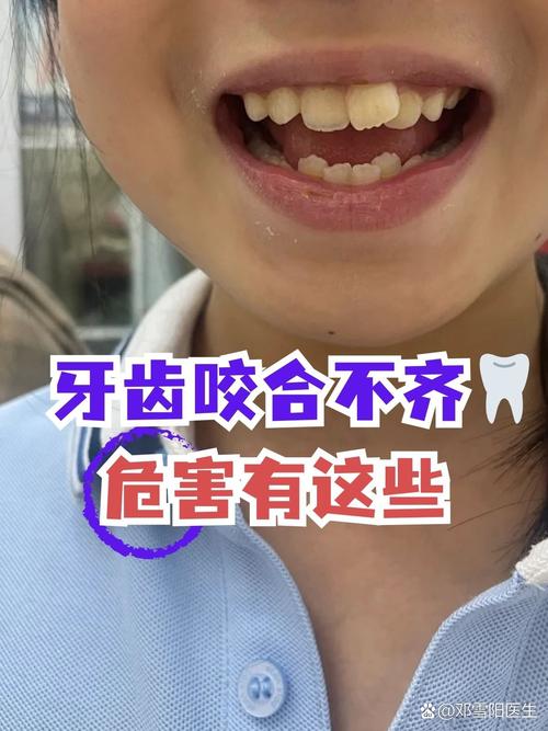 咬合不好 植牙-图1