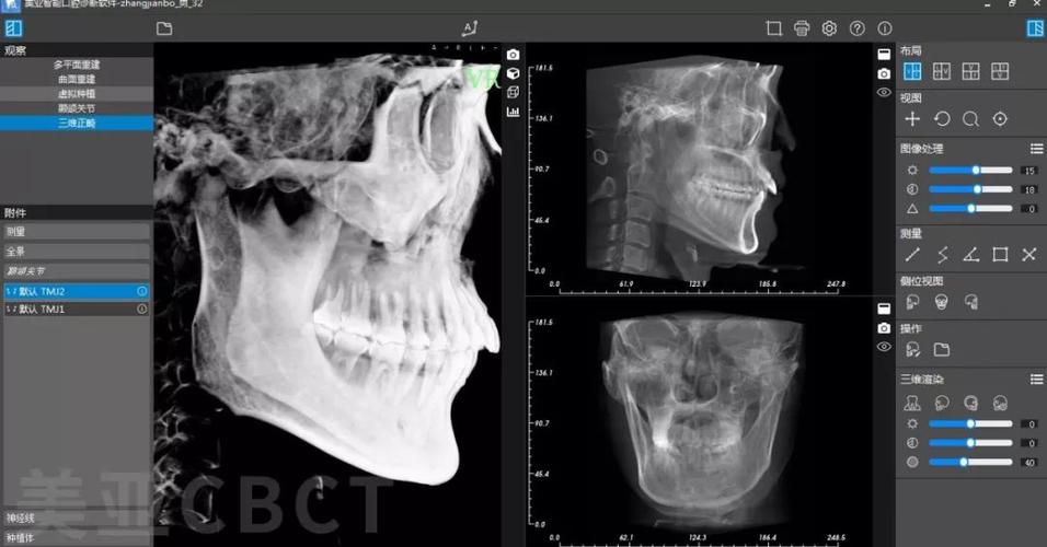 口腔正畸头颅侧位片-图2 口腔正畸头颅侧位片-图2
