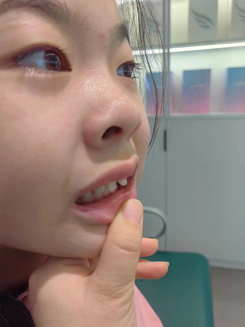 深圳儿童医院 正畸-图2