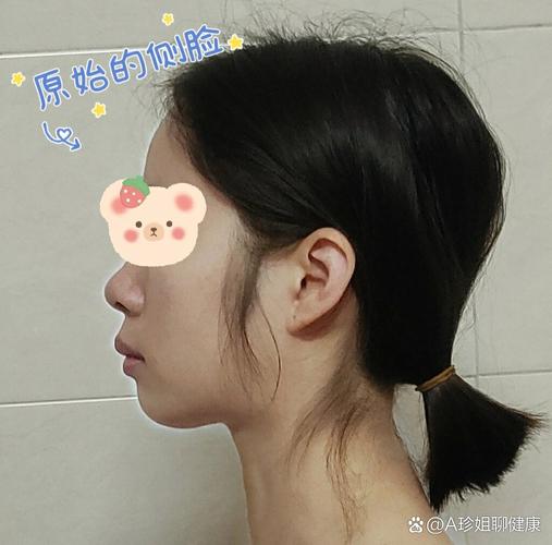 光华口腔医院 正畸-图1